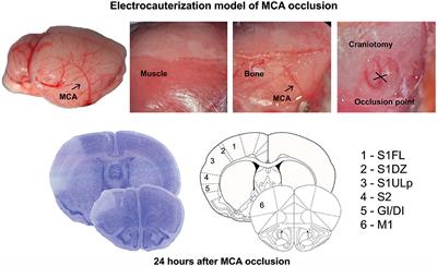 Genetic Deletion of mGlu3 Metabotropic Glutamate Receptors Amplifies Ischemic Brain Damage and Associated Neuroinflammation in Mice